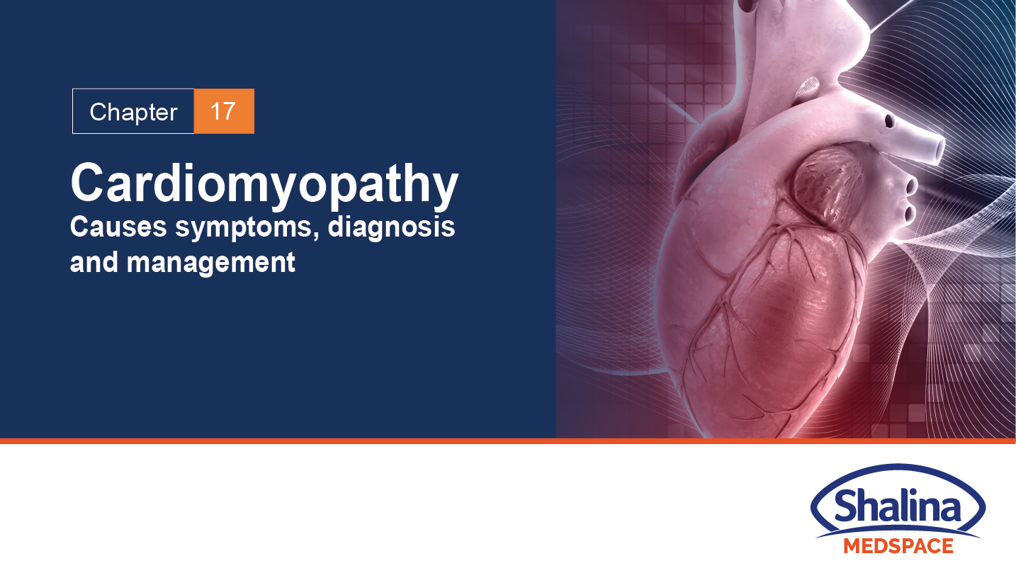 Cardiomyopathy